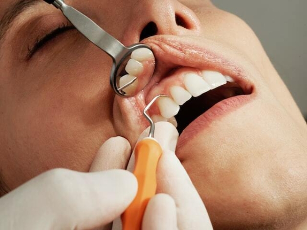 Стоматология или ботокс? Как лечение зубов омолаживает