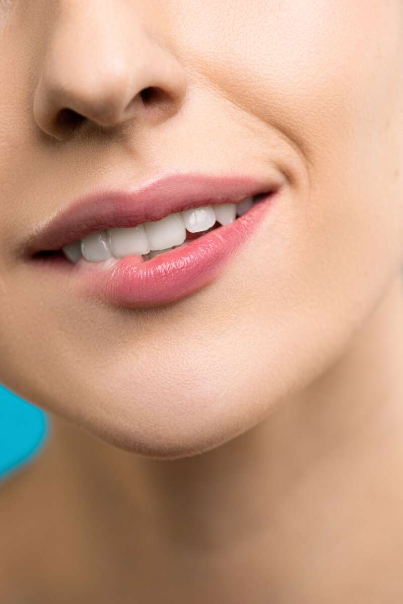 Виниры на зубы: преображение улыбки с помощью эстетической стоматологии