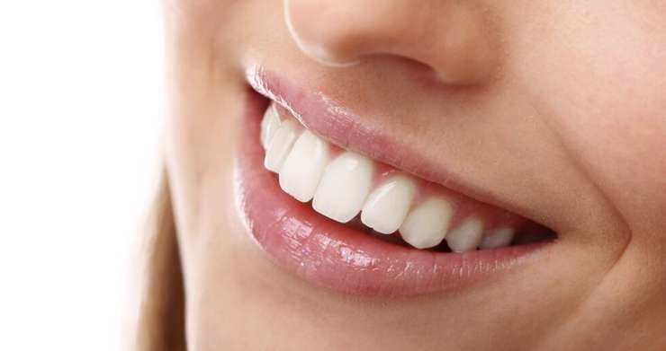 Четыре мифа о винирах, в которые вы все еще верите Четыре мифа о винирах, в которые вы все еще верите