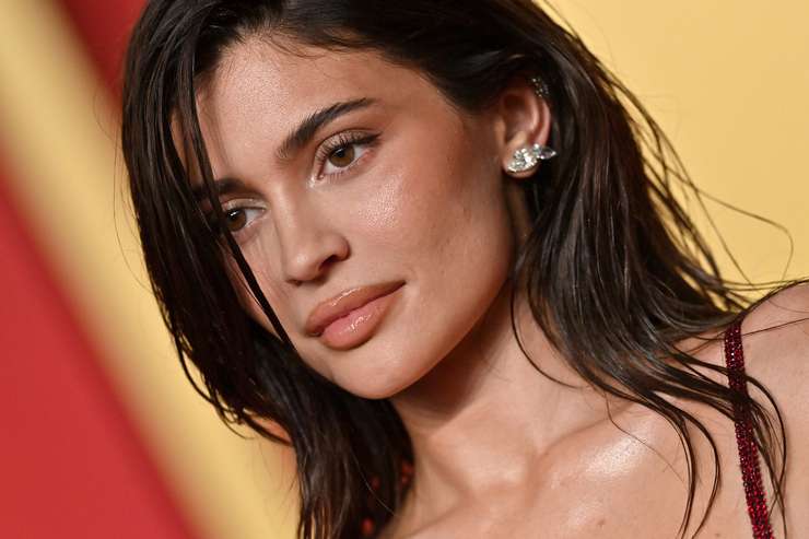 Миграция филлеров: почему лица Энистон и Дженнер опухшие и неровные Миграция филлеров: почему лица Энистон и Дженнер опухшие и неровные