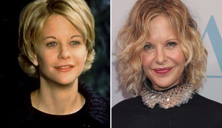 Миграция филлеров: почему лица Энистон и Дженнер опухшие и неровные Миграция филлеров: почему лица Энистон и Дженнер опухшие и неровные