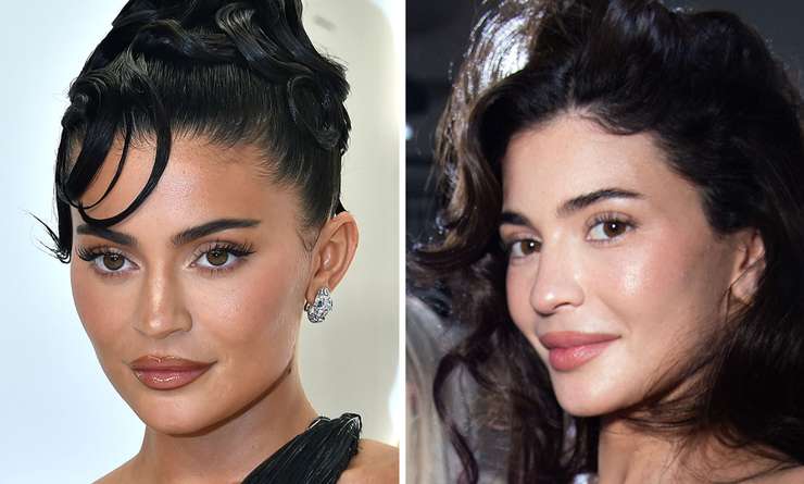 Миграция филлеров: почему лица Энистон и Дженнер опухшие и неровные Миграция филлеров: почему лица Энистон и Дженнер опухшие и неровные