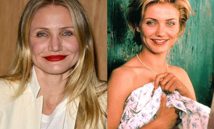 Миграция филлеров: почему лица Энистон и Дженнер опухшие и неровные Миграция филлеров: почему лица Энистон и Дженнер опухшие и неровные