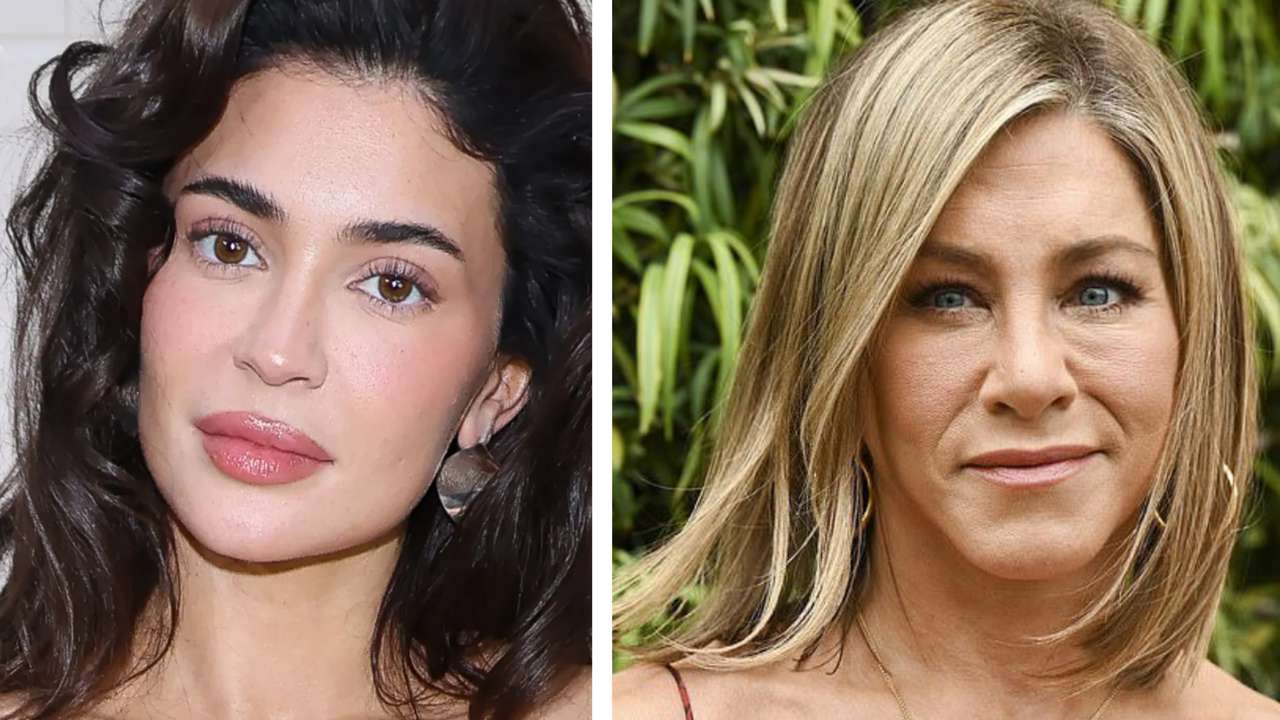 Миграция филлеров: почему лица Энистон и Дженнер опухшие и неровные Миграция филлеров: почему лица Энистон и Дженнер опухшие и неровные