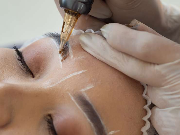 Неудачный татуаж: что делать, если испорчено лицо Неудачный татуаж: что делать, если испорчено лицо