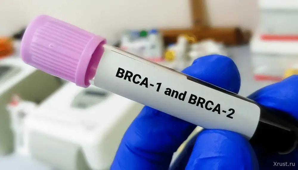 Тесты BRCA и рак молочной железы – это надо знать Тесты BRCA и рак молочной железы – это надо знать